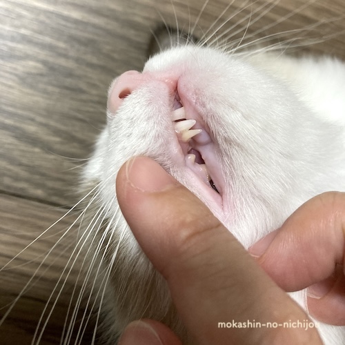 乳歯と永久歯が混在する